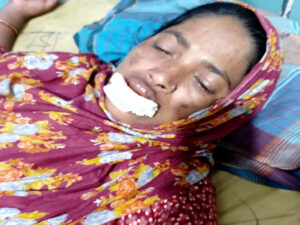 নন্দীগ্রামে জমিজমা সংক্রান্তে প্রতিপক্ষের হামলায় আহত নারী