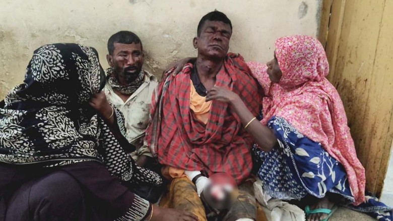 শার্শায় পুতে রাখা বোমার বিস্ফোরণে দুই শ্রমিক আহত