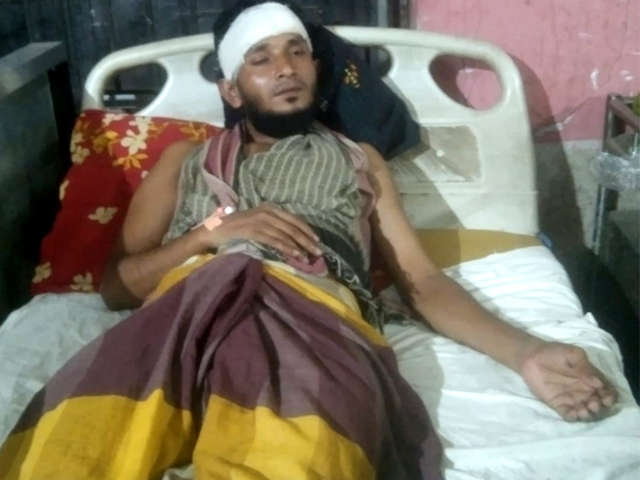 বেনাপোলে কিশোর গ্যাং এর হামলায় আহত সেলুন ব্যবসায়ী